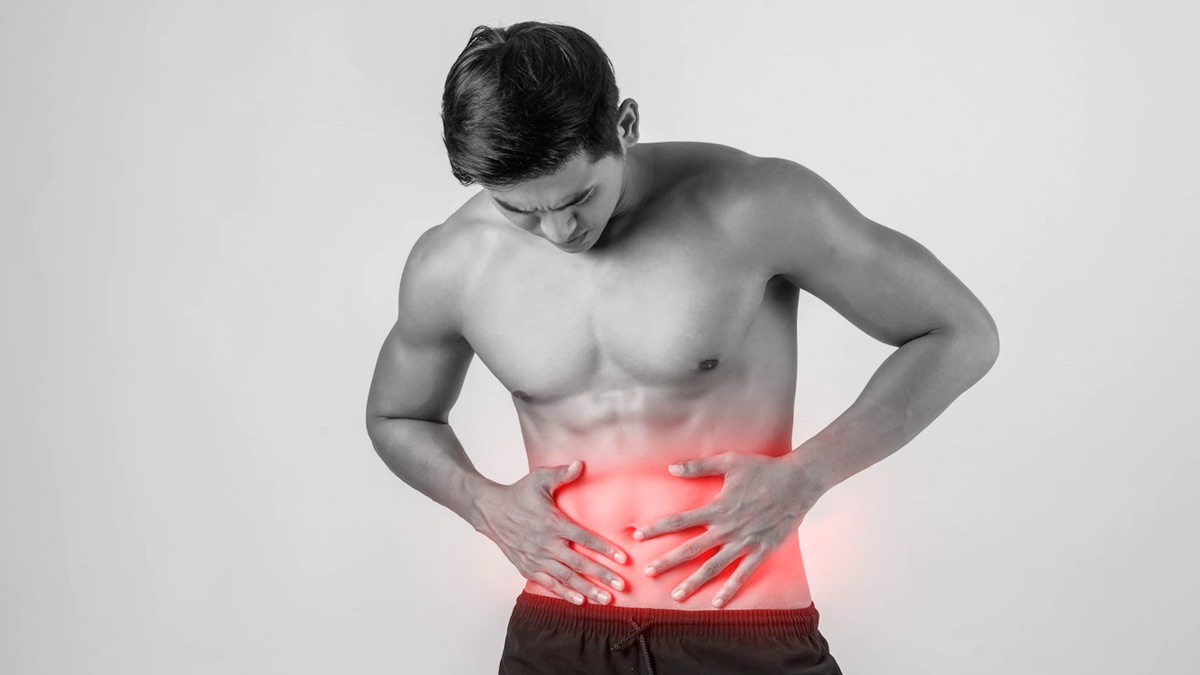 colon cancer